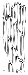 Kiaeria pumila, laminal cells of leaf base, c. 300 µm above insertion. Drawn from A.J. Fife 7312, CHR 406479.
 Image: R.C. Wagstaff © Landcare Research 2018 